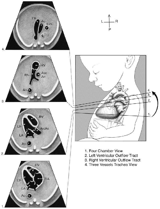 美国医学超声协会胎儿超声心动图操作指南