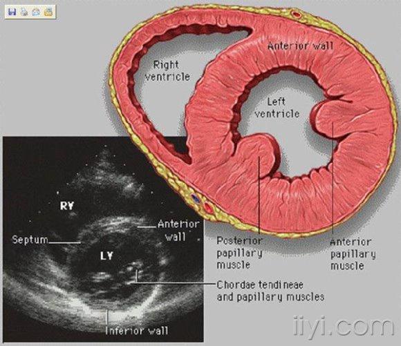 心脏彩超解剖图2