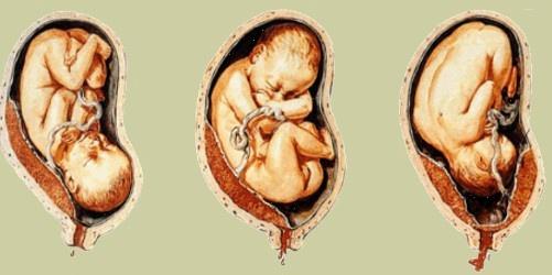 子宫下段, 甚至胎盘下缘达到或覆盖宫颈内口处,其位置低于胎儿先露部