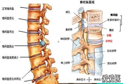 的基础上,产生椎间盘和相应椎间关节及其附属组织一系列的病理变化