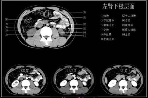 腹部ct各层面图集