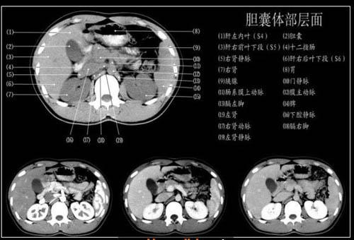 腹部ct各层面图集