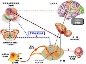 新版神经病理性疼痛诊疗共识发布