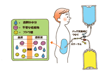 慢性腹膜透析治疗肾病儿童贫血进展