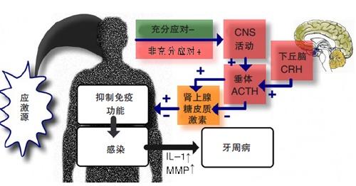 心理应激或影响牙周感染进展