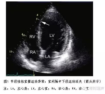 临床医生如何正确理解和解读超声心动图报告