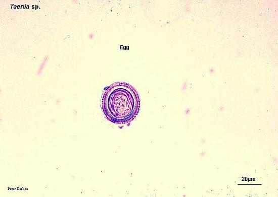 绦虫卵图片显微镜图片
