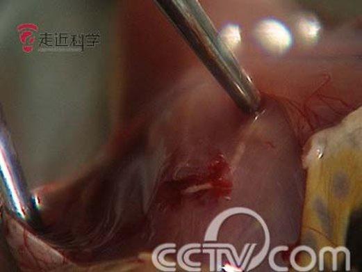 猪肉绦虫成虫(猪肉内)