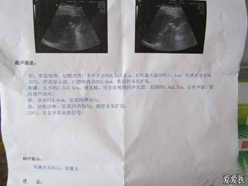 急性阑尾炎一般几天才能恢复正常 z13103641682oi6uu.jpg