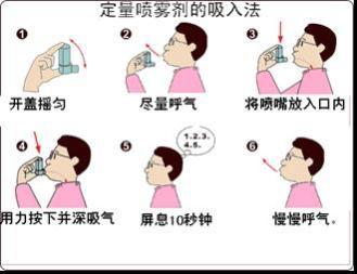 定量吸入器临床上雾化吸入器主要包括三种,现在将该三种