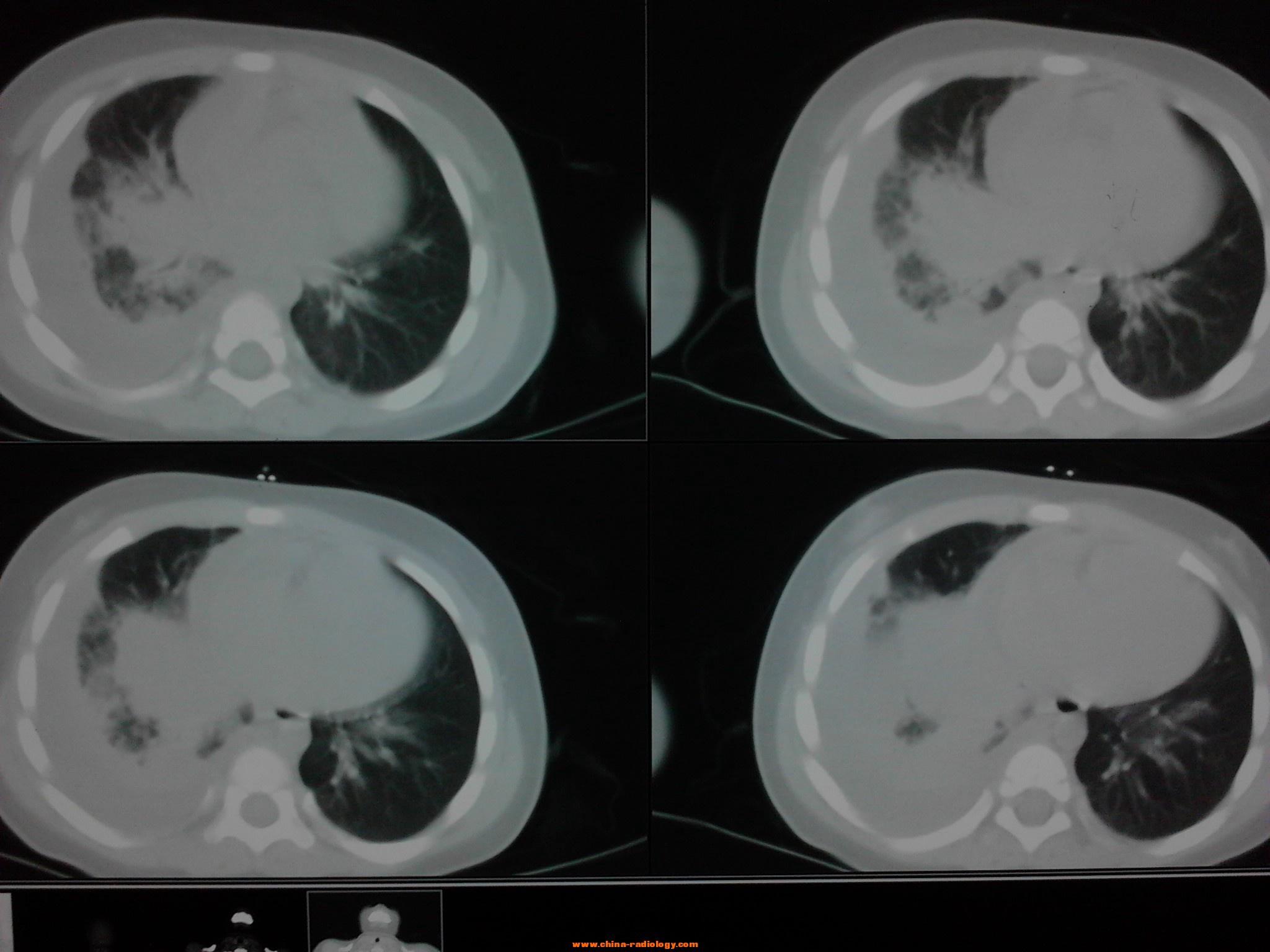 看图识病ct图片1