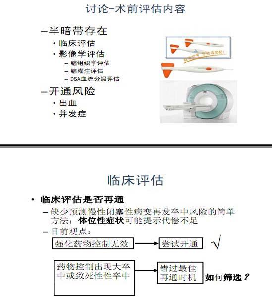 李天曉，非急性期顱內(nèi)動脈閉塞的再通治療及評估討論18