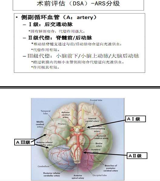 李天曉，非急性期顱內(nèi)動脈閉塞的再通治療及評估討論23