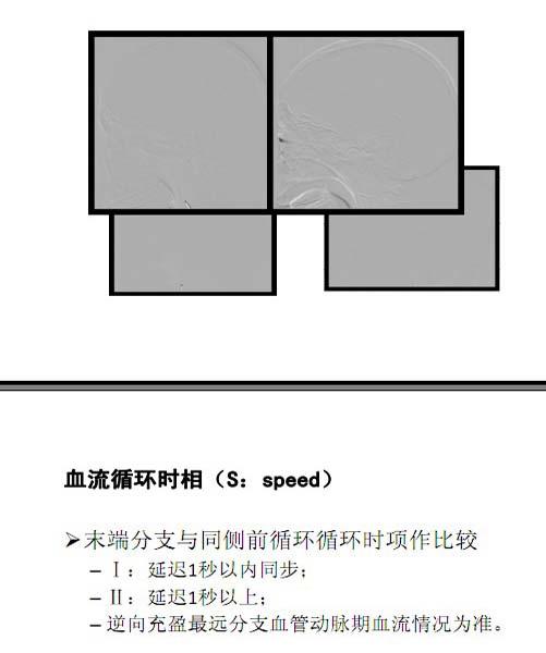 李天曉，非急性期顱內(nèi)動脈閉塞的再通治療及評估討論25