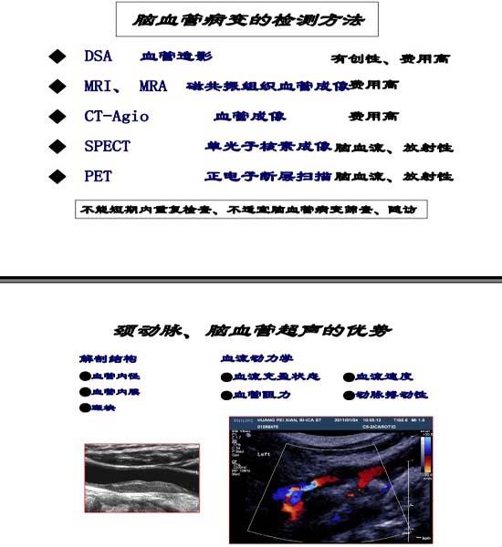 华扬，脑卒中高危人群的规范化血管超声检测与治疗评估3