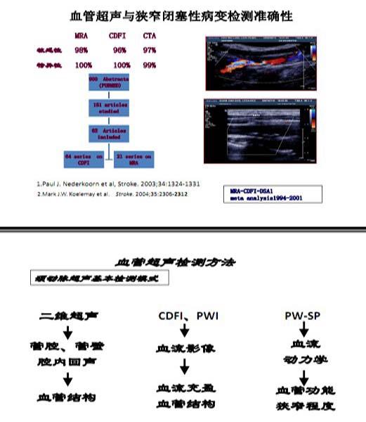 華揚(yáng)，腦卒中高危人群的規(guī)范化血管超聲檢測與治療評估4