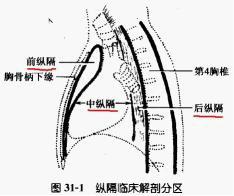 纵隔肿瘤