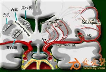 急性腦缺血