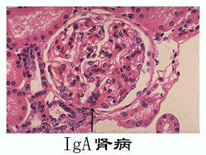 z13837015641m293jk3.jpg