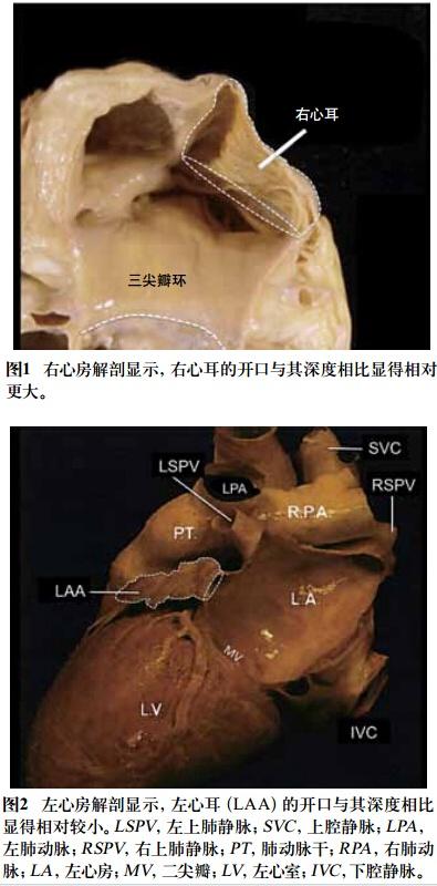 房颤采用机械方式闭合左心耳现在是否应积极些