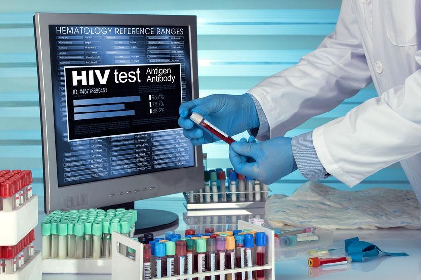 HIV感染者在普通血液检查中的蛛丝马迹