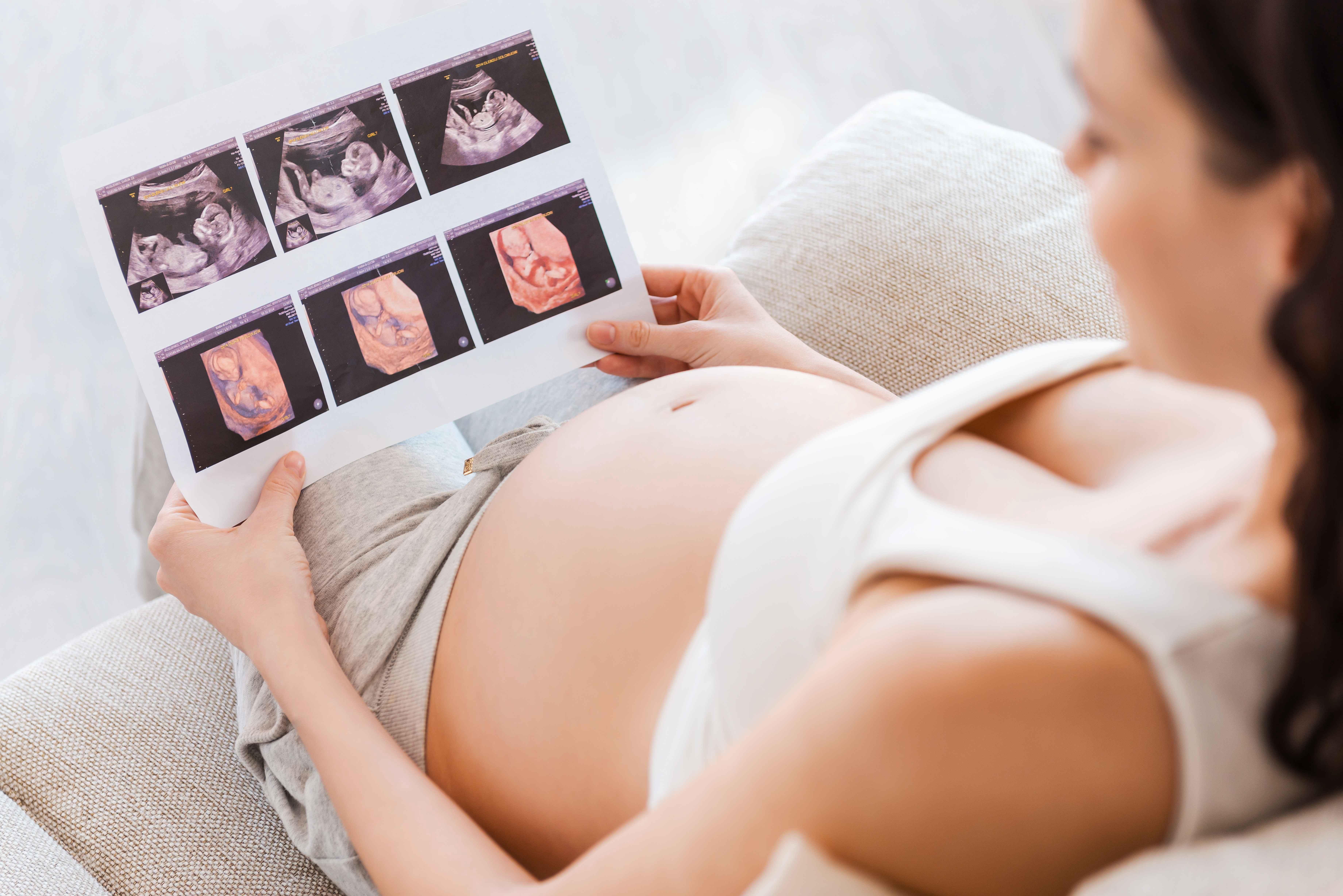 Беременной снится шевеление ребенка. УЗИ беременных. Шевеления ребёнка в животе. УЗИ беременных 3 триместр.