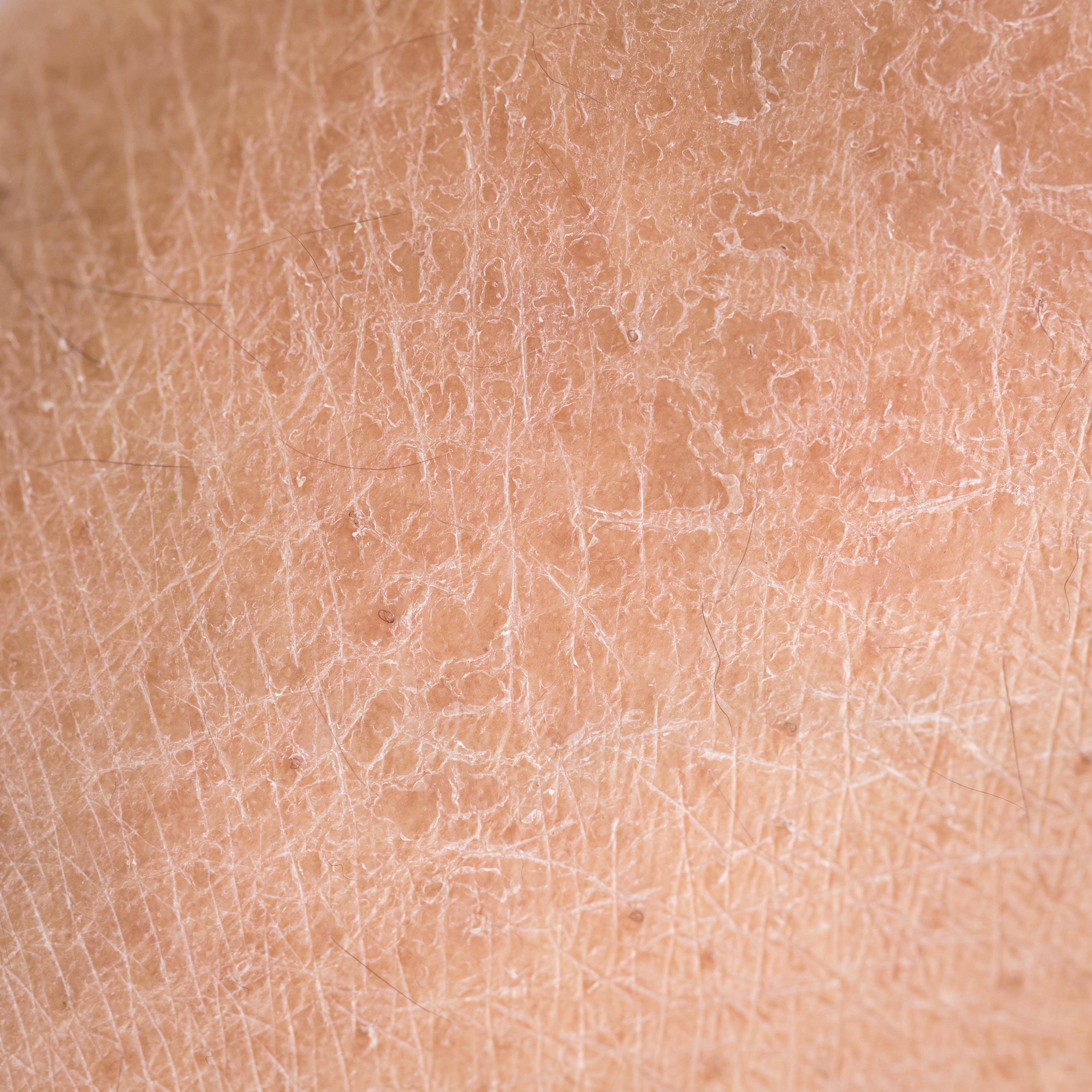 常見皮膚科皮膚病損的形態和分布
