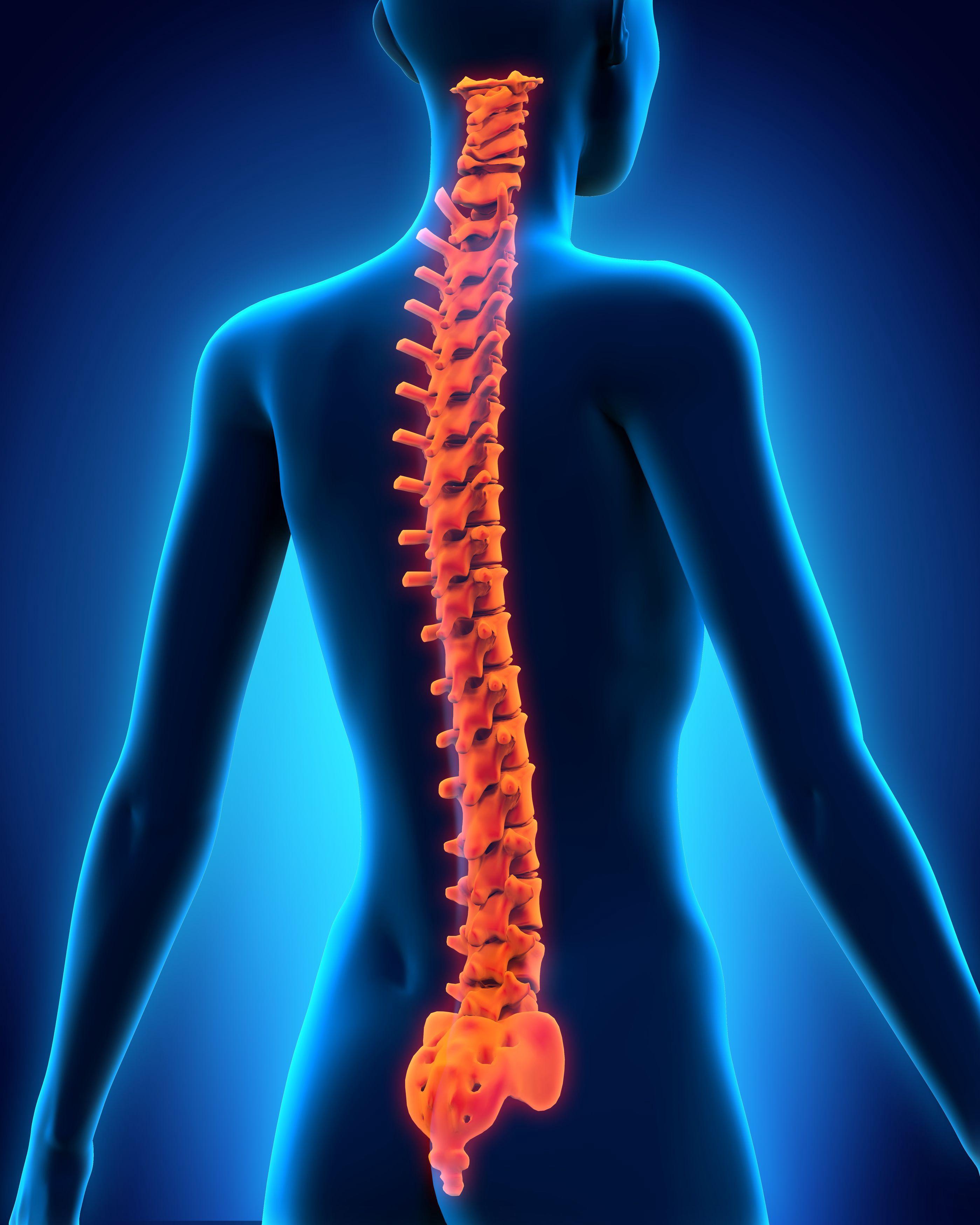 X线、CT和MRI对强直性脊柱炎的诊断分析
