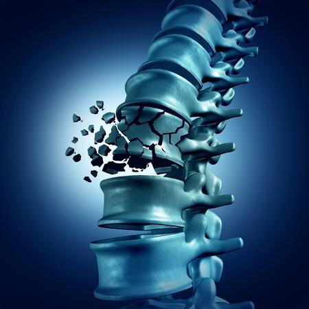 经皮椎体后凸成形术治疗骨质疏松性腰椎压缩性骨折体会