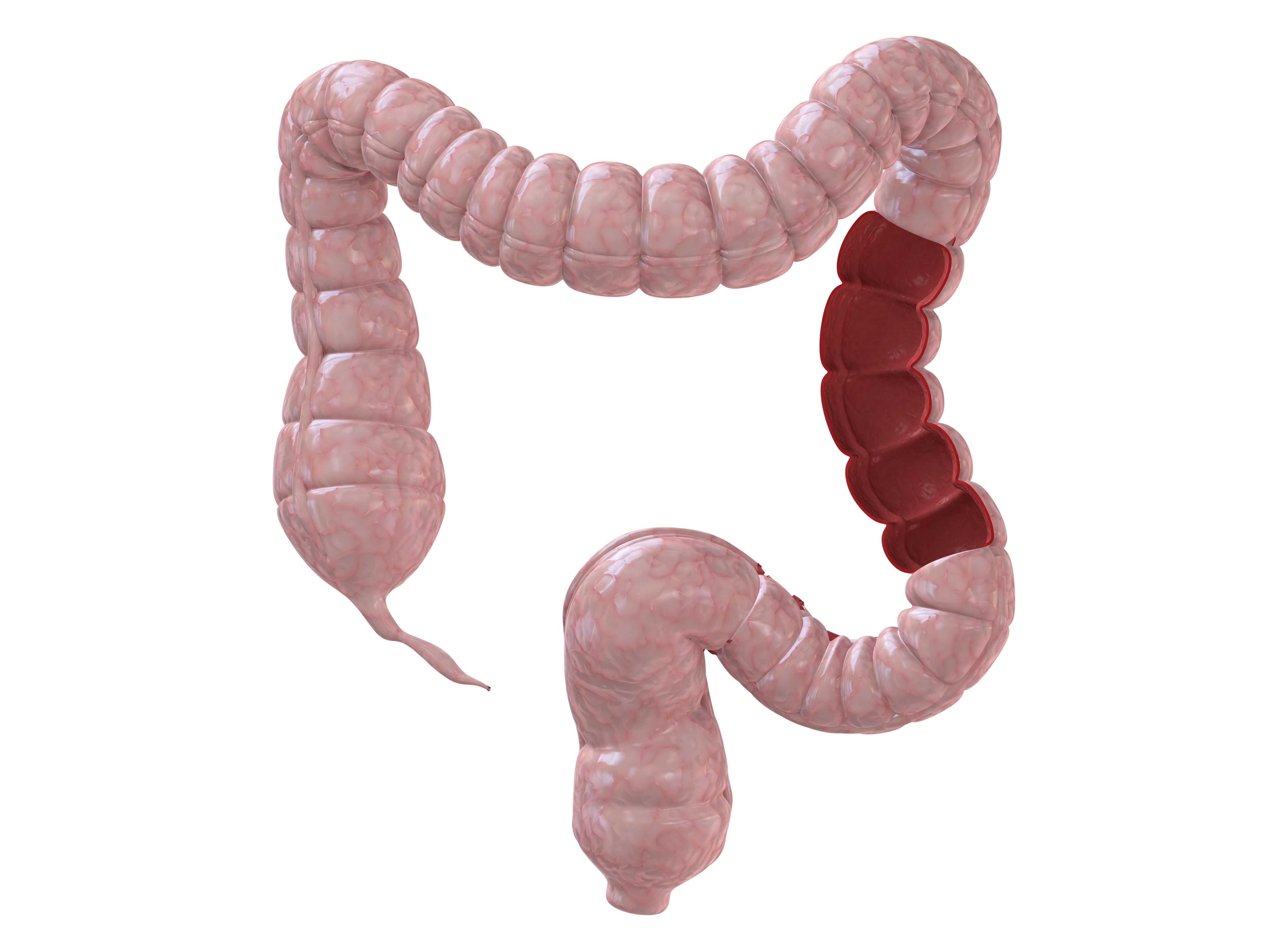 结肠肠壁分层示意图,结肠图,大肠肠壁分层示意图_大山谷图库