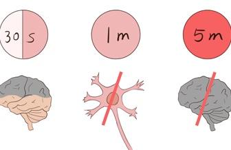作者 爱医杂志 病例中心 【优选漫画】急性脑梗死的诊断与治疗(下) 有